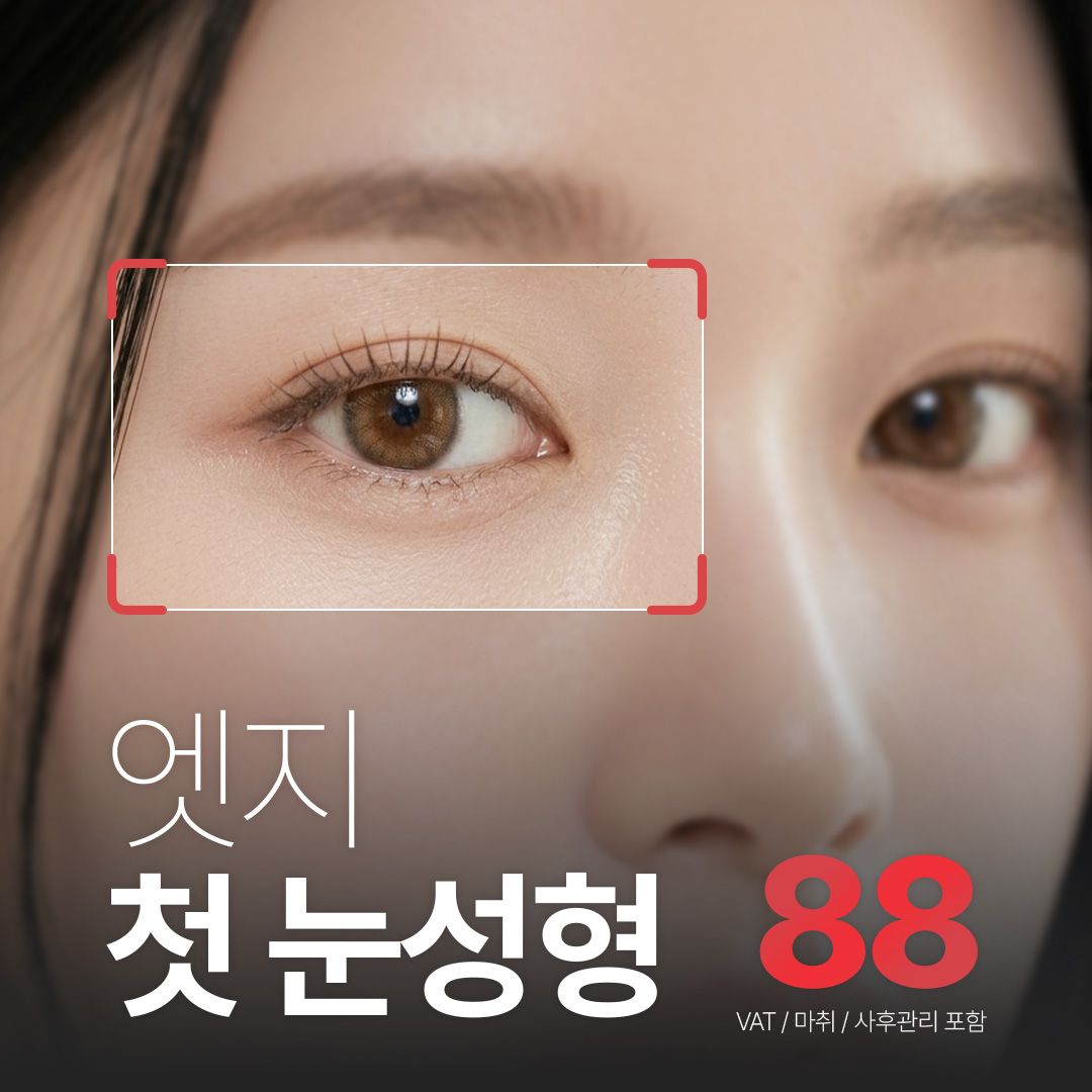 대구 엣지 토탈 눈성형_자연유착, 부분절개, 절개, 눈매교정, 트임, 상안검