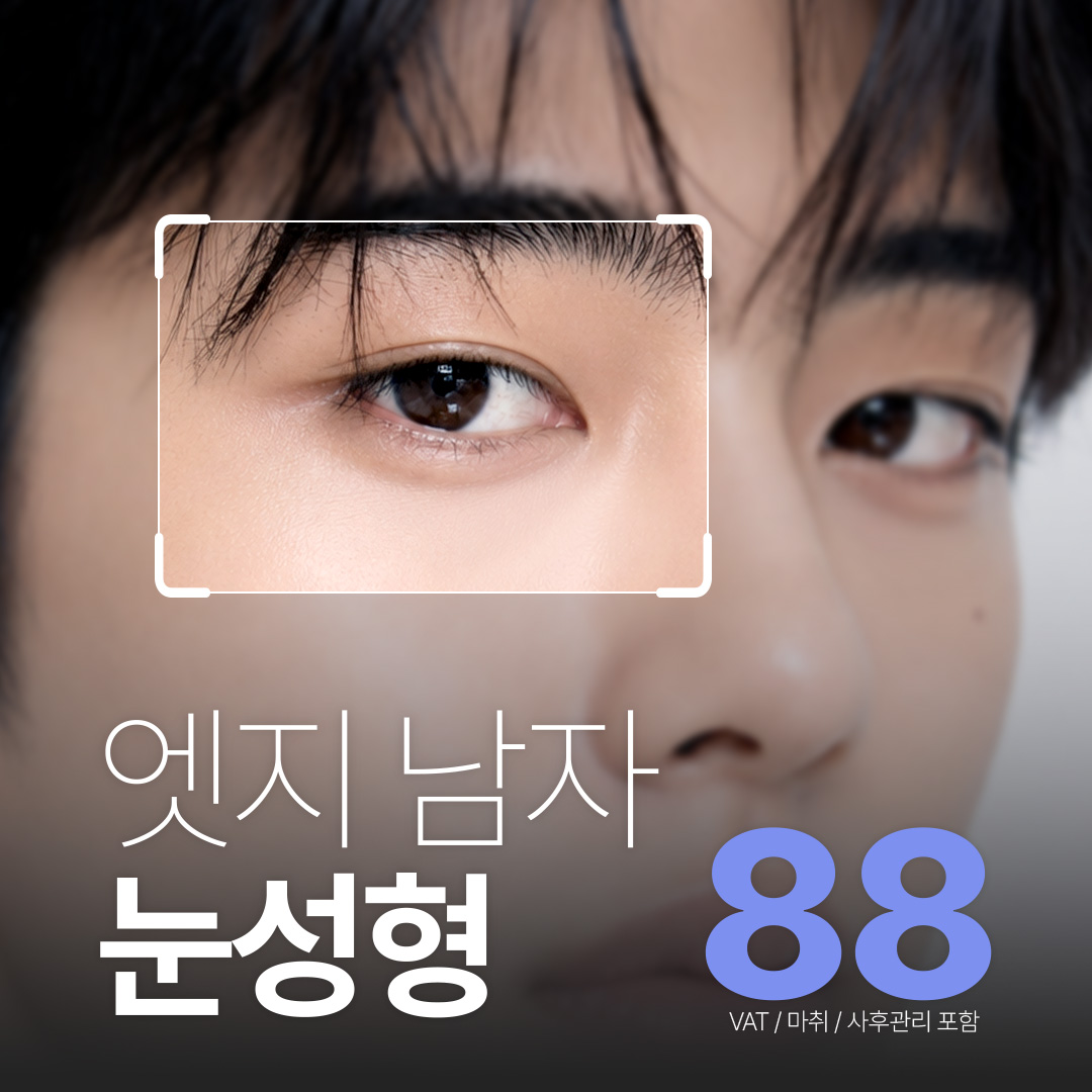 대구 엣지 남자 눈성형