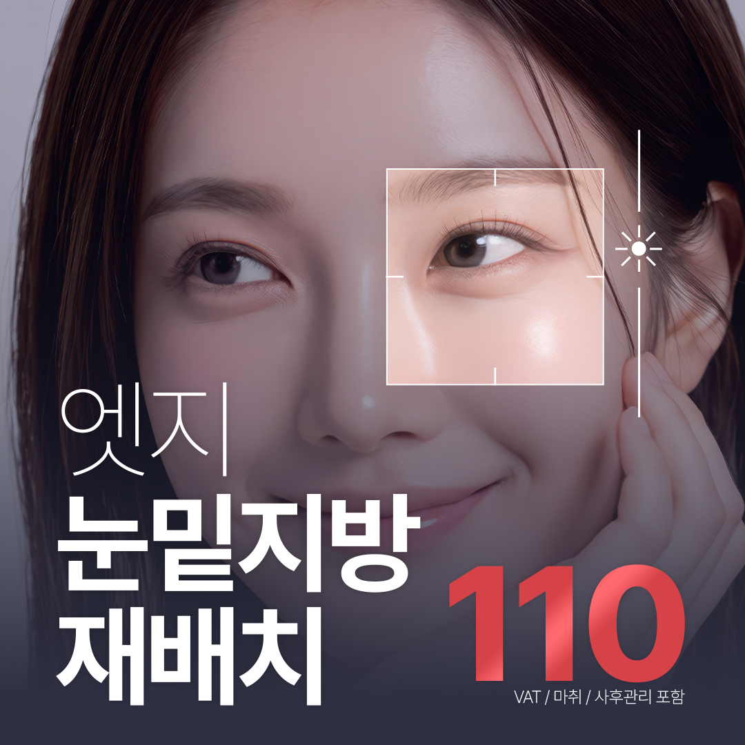 대구 엣지 눈성형_눈밑지방재배치