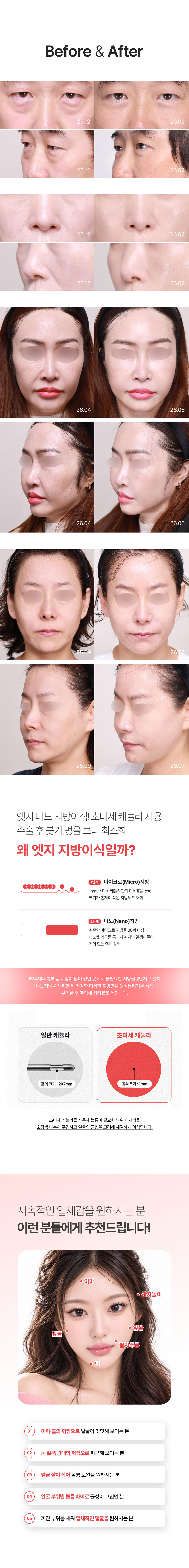 이벤트 상세 안내 2